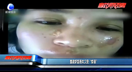 微波炉加热太久变“炸蛋”