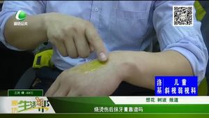 烧烫伤后抹牙膏靠谱吗