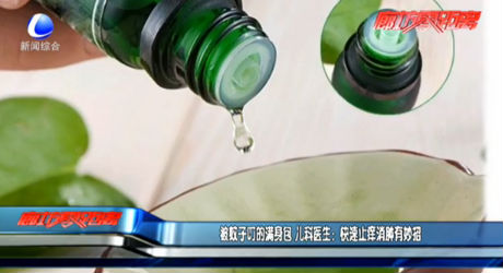 被蚊子叮的满身包 儿科医生：快速止痒消肿有妙招