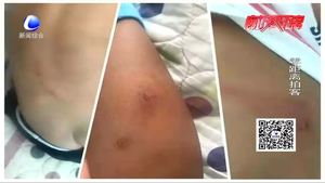 小区地砖塌陷现暗井 孩子被卡多处擦伤