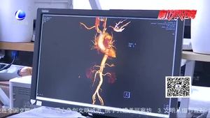 中石油医院历时6小时成功抢救一位复合外伤心脏破裂患者